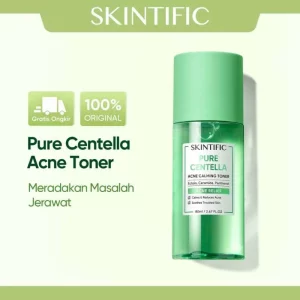 5 Manfaat Toner Skintific Acne untuk Kulit Berjerawat, Wajib Tahu!